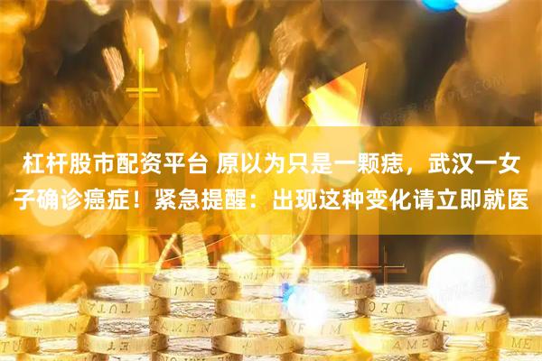 杠杆股市配资平台 原以为只是一颗痣，武汉一女子确诊癌症！紧急提醒：出现这种变化请立即就医